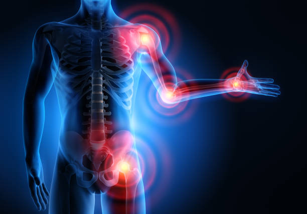 Human body x-ray showing inflammation in joints